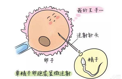 美国试管取卵与移植真的很疼吗？听梦美专家怎么说