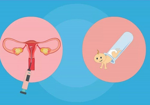 赴泰试管婴儿面对子宫肌瘤成功好孕的3大方案剖析