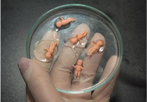 赴泰生子过程注意事项_2